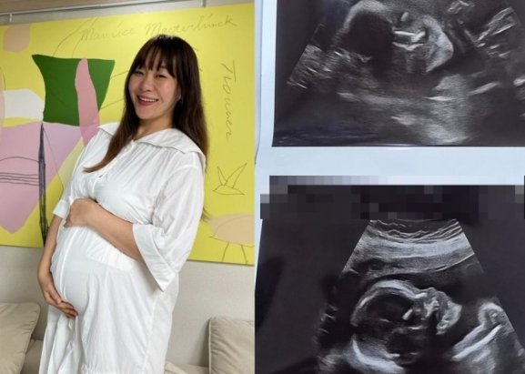 Comedian Jung Juri Reveals Ultrasound of Her Fifth Son on Instagram, Sparking Joyful Reactions from Fans and Friends - OUR K-POP